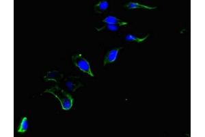 Immunofluorescent analysis of Hela cells using ABIN7147399 at dilution of 1:100 and Alexa Fluor 488-congugated AffiniPure Goat Anti-Rabbit IgG(H+L) (CEP192 Antikörper  (AA 447-711))