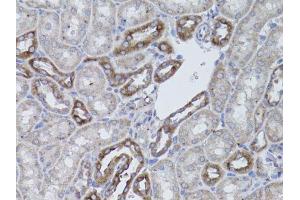 Immunohistochemistry (Paraffin-embedded Sections) (IHC (p)) image for anti-Integrin alpha V (ITGAV) (C-Term) antibody (ABIN3022888)