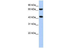 ELAC1 antibody used at 1 ug/ml to detect target protein. (ELAC1 Antikörper)