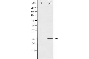 Western blot analysis of eIF4E expression in FBS treated NIH-3T3 whole cell lysates,The lane on the left is treated with the antigen-specific peptide. (EIF4E Antikörper  (C-Term))