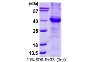Image no. 1 for Amyloid beta (A4) Precursor Protein (APP) protein (His tag) (ABIN1098609) (APP Protein (His tag))