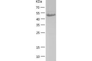 PDHX Protein (AA 54-501) (His tag)