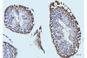 IHC analysis of SBNO1 using anti-SBNO1 antibody (ABIN7601710). (SBNO1 Antikörper  (AA 43-1303))