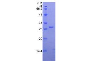 SDS-PAGE analysis of Human Elastase 3B Protein. (Elastase 3B Protein)