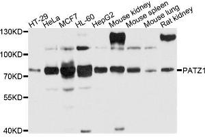 Western blot analysis of extracts of various cells, using PATZ1 antibody. (PATZ1 Antikörper)