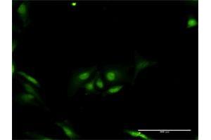 Immunofluorescence of purified MaxPab antibody to ORC6L on HeLa cell. (ORC6 Antikörper  (AA 1-252))
