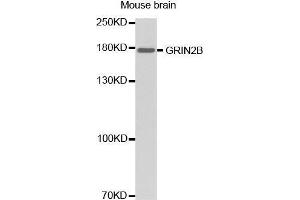 Western Blotting (WB) image for anti-Glutamate Receptor, Ionotropic, N-Methyl D-Aspartate 2B (GRIN2B) (C-Term) antibody (ABIN1680110) (GRIN2B Antikörper  (C-Term))