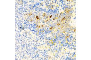 Immunohistochemistry of paraffin-embedded mouse spleen using PROK2 antibody (ABIN5975051) at dilution of 1/100 (40x lens). (PROK2 Antikörper)
