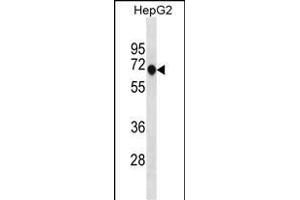 ANKDD1A Antibody (C-term) (ABIN1881056 and ABIN2838750) western blot analysis in HepG2 cell line lysates (35 μg/lane). (ANKDD1A Antikörper  (C-Term))
