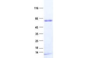PNMA3 Protein (His tag)
