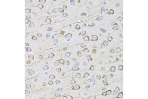 Immunohistochemistry of paraffin-embedded mouse brain using MIP antibody (ABIN3016917, ABIN3016918, ABIN3016919 and ABIN6219879) at dilution of 1:100 (40x lens). (Mip (AA 50-150) Antikörper)