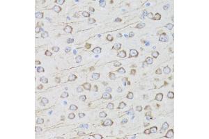 Immunohistochemistry of paraffin-embedded mouse brain using MIP antibody (ABIN3016917, ABIN3016918, ABIN3016919 and ABIN6219879) at dilution of 1:100 (40x lens). (Mip (AA 50-150) Antikörper)