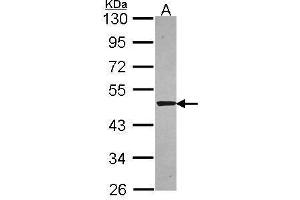 WB Image Sample (30 ug of whole cell lysate) A: A549 10% SDS PAGE antibody diluted at 1:5000 (SNTA1 Antikörper)