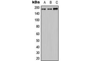 Western blot analysis of MRP2 expression in HeLa (A), mouse brain (B), H9C2 (C) whole cell lysates. (ABCC2 Antikörper  (Center))