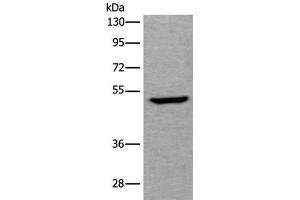 Western blot analysis of Human fetal liver tissue lysate using UMPS Polyclonal Antibody at dilution of 1:400 (UMPS Antikörper)