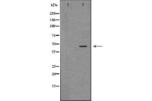 Western blot analysis of extracts of mouse skeletal muscle, using ANGPTL4 antibody. (ANGPTL4 Antikörper  (N-Term))