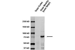 Western blot analysis of Rat kidney tissue lysates showing detection of ENaC protein using Rabbit Anti-ENaC Polyclonal Antibody . (SCNN1A Antikörper  (AA 629-650) (Atto 488))