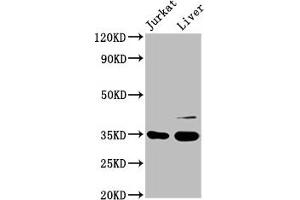Western Blot Positive WB detected in: Jurkat whole cell lysate, Rat liver tissue All lanes: GAS2 antibody at 3. (GAS2 Antikörper  (AA 1-141))