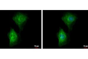 ICC/IF Image PDE4B antibody detects PDE4B protein at cytoplasm by immunofluorescent analysis. (PDE4B Antikörper)