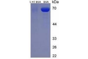 SDS-PAGE of Protein Standard from the Kit (BSA-5-HT).