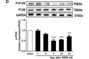 The CXCR7 and PI3K/Akt signaling pathways are involved in CPSP in the dorsal horn of the spinal cord. (GAPDH Antikörper)