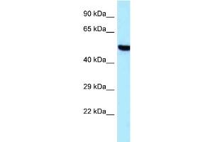 Western Blotting (WB) image for anti-threonyl-tRNA Synthetase 2, Mitochondrial (TARS2) (C-Term) antibody (ABIN2789298) (TARS2 Antikörper  (C-Term))