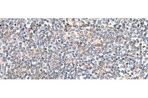 Immunohistochemistry of paraffin-embedded Human tonsil tissue using ITGA3 Polyclonal Antibody at dilution of 1:45(x200) (ITGA3 Antikörper)