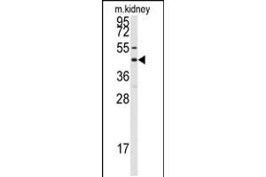 Western blot analysis of anti-GJA8 Antibody in mouse kidney tissue lysates (35ug/lane)