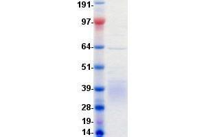 Western Blotting (WB) image for RYK Receptor-Like Tyrosine Kinase (RYK) protein (DYKDDDDK-His Tag) (ABIN5505758)