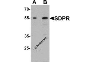 Western Blotting (WB) image for anti-Polymerase I and Transcript Release Factor (PTRF) (C-Term) antibody (ABIN1077453) (PTRF Antikörper  (C-Term))