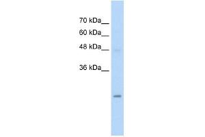 HIP2 antibody used at 5 ug/ml to detect target protein. (UBE2K Antikörper  (N-Term))