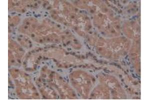 IHC-P analysis of Human Kidney Tissue, with DAB staining. (ATG7 Antikörper  (AA 429-488))