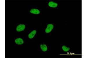 Immunofluorescence of purified MaxPab antibody to AOF2 on HeLa cell.