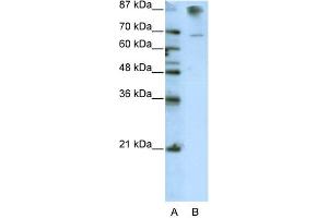 WB Suggested Anti-HKR1 Antibody Titration:  0. (HKR1 Antikörper  (C-Term))