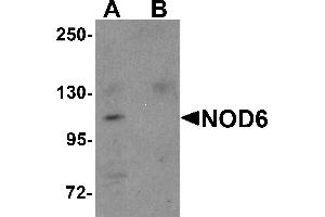 Western Blotting (WB) image for anti-NLR Family, Pyrin Domain Containing 9 (NLRP9) (N-Term) antibody (ABIN1031485) (NLRP9 Antikörper  (N-Term))