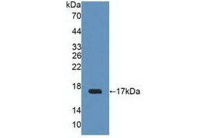 Detection of Recombinant UPK2, Human using Polyclonal Antibody to Uroplakin 2 (UPK2) (Uroplakin 2 Antikörper  (AA 26-153))