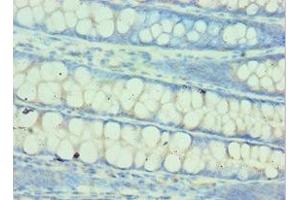 Immunohistochemistry of paraffin-embedded human colon tissue using ABIN7154026 at dilution of 1:100 (QARS Antikörper  (AA 1-250))