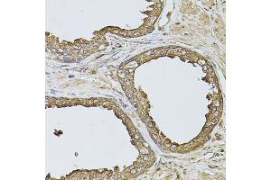 Immunohistochemistry of paraffin-embedded human prostate using ANXA8L2 antibody (ABIN5975720) at dilution of 1/100 (40x lens). (ANXA8L2 Antikörper)