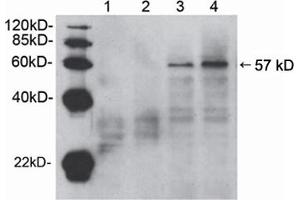 Western blot analysis of cell lysates from HEK-293 (lane 1 and 3) and NIH/3T3 (lane 2 and 4) cells,using Rabbit Anti-Akt (Ser473) Polyclonal Antibody (ABIN398622) . (AKT1 Antikörper  (pSer473))