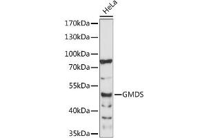 Western blot analysis of extracts of HeLa cells, using GMDS antibody (ABIN6294083) at 1:1000 dilution. (GMDS Antikörper)