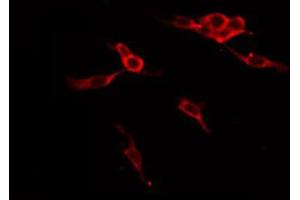 Immunofluorescence (fixed cells) (IF/ICC) image for anti-UDP-Gal:betaGlcNAc beta 1,4 Galactosyltransferase, Polypeptide 1 (B4GALT1) (C-Term) antibody (ABIN6259493)