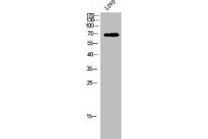 Western Blot analysis of LOVO cells using ZP1 Polyclonal Antibody (ZP1 Antikörper  (Internal Region))