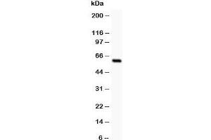 Western blot testing of SSTR1 antibody and rat intestine lysate;  The protein is routinely visualized from 42~80KD due to glycosylation. (SSTR1 Antikörper  (AA 361-381))