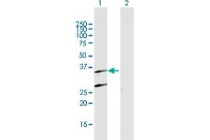 Western Blot analysis of PSMB7 expression in transfected 293T cell line by PSMB7 MaxPab polyclonal antibody. (PSMB7 Antikörper  (AA 1-277))