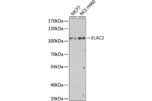 Western blot analysis of extracts of various cell lines, using EL Antibody (ABIN6132052, ABIN6140108, ABIN6140109 and ABIN6222942) at 1:1000 dilution. (ELAC2 Antikörper  (AA 1-270))