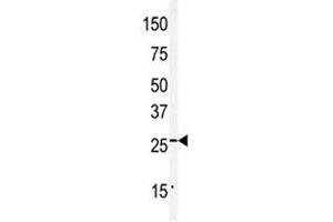 Western Blotting (WB) image for anti-Claudin 2 (CLDN2) (AA 190-220) antibody (ABIN3028572)