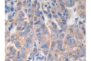 Immunohistochemistry (IHC) image for anti-A Kinase (PRKA) Anchor Protein 11 (AKAP11) (AA 1650-1901) antibody (ABIN7443557)