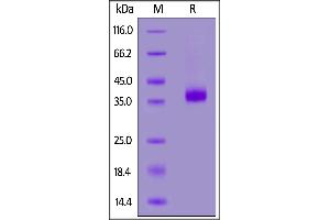 SDS-PAGE (SDS) image for CD2 (CD2) (AA 25-209) (Active) protein (His tag,AVI tag,Biotin) (ABIN7013810)