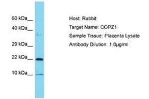 Image no. 1 for anti-Coatomer Protein Complex, Subunit zeta 1 (COPZ1) (C-Term) antibody (ABIN6750829) (COPZ1 Antikörper  (C-Term))