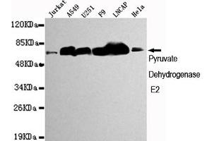 Western blot detection of Pyruvate Dehydrogenase E2 in Jurkat,A549,,F9,Lncap and Hela cell lysates using Pyruvate Dehydrogenase E2 mouse mAb (1:1000 diluted). (CYB561 Antikörper)